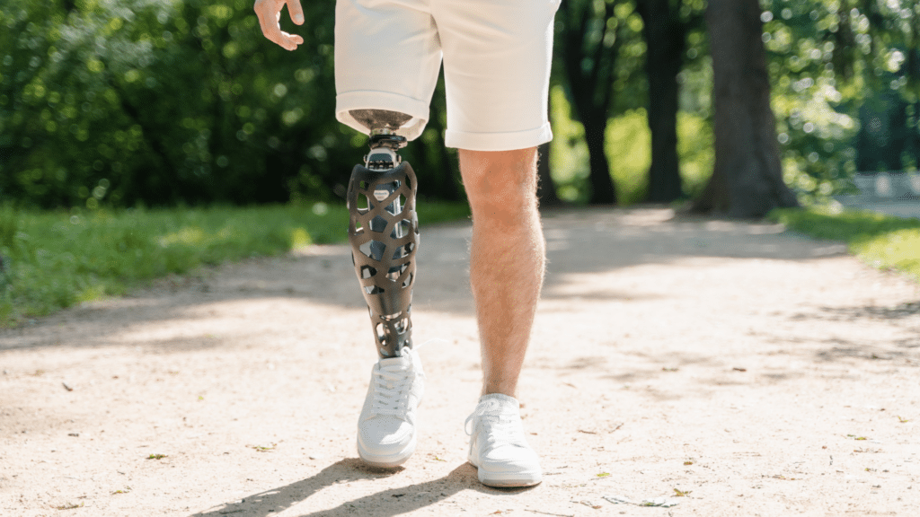 EMG Sensor in Prosthetics